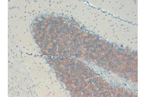 KCHIP Immunohistochemistry. (KCNIP1 antibody)