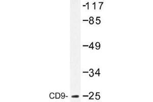 Image no. 1 for anti-CD9 (CD9) antibody (ABIN317808) (CD9 antibody)