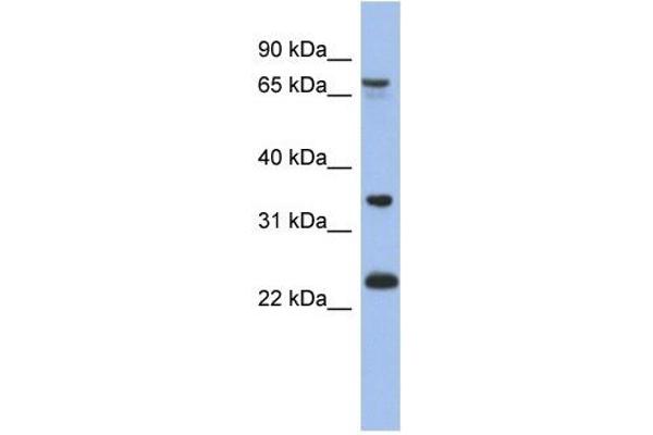 TBC1D25 antibody  (N-Term)