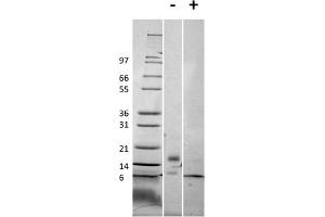 SDS-PAGE of Mouse RELM beta Recombinant Protein SDS-PAGE of Mouse RELM beta Recombinant Protein. (RETNLB Protein)