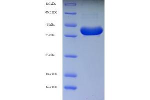 SDS-PAGE (SDS) image for Interleukin 3 (IL-3) (AA 20-152) protein (GST tag) (ABIN5709745) (IL-3 Protein (AA 20-152) (GST tag))