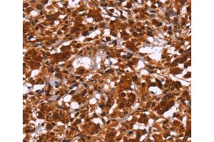 Immunohistochemistry (IHC) image for anti-Homeodomain Interacting Protein Kinase 1 (HIPK1) antibody (ABIN2433125) (HIPK1 antibody)