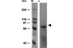 Western Blotting (WB) image for anti-Heat Shock Protein 70 (HSP70) antibody (ABIN191986) (HSP70 antibody)