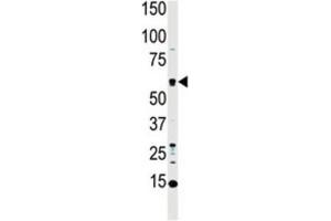 Western Blotting (WB) image for anti-Macrophage Stimulating 1 (Hepatocyte Growth Factor-Like) (MST1) antibody (ABIN3003576) (MST1 antibody)