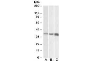Western blot testing of A) human, B) mouse and C) rat skeletal muscle lysates with TNNT3 antibody at 0. (TNNT3 antibody)