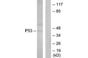 Western blot analysis of extracts from Ovary cancer cells, using p53 (Ab-18) Antibody. (p53 antibody  (AA 15-64))