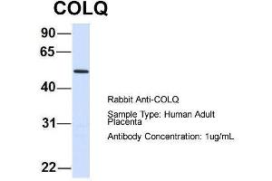 Host:  Rabbit  Target Name:  COLQ  Sample Type:  Human Adult Placenta  Antibody Dilution:  1. (COLQ antibody  (N-Term))