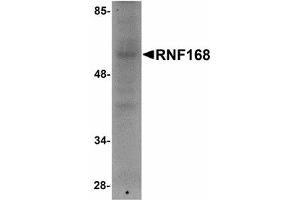 Image no. 1 for anti-Ring Finger Protein 168 (RNF168) (C-Term) antibody (ABIN478081) (RNF168 antibody  (C-Term))