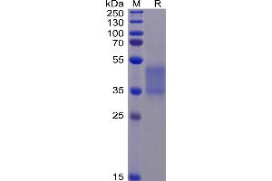 Human FA Protein (F176V), His Tag on SDS-PAGE under reducing condition. (FCGR3A Protein (AA 17-206) (His tag))