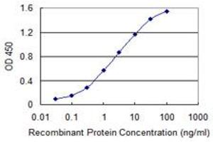 Detection limit for recombinant GST tagged SECISBP2 is 0. (SECISBP2 antibody  (AA 106-205))