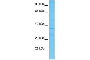 Host:  Rabbit  Target Name:  EXTL2  Sample Type:  Fetal Kidney lysates  Antibody Dilution:  1. (EXTL2 antibody  (C-Term))