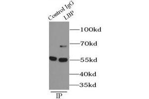 Immunoprecipitation (IP) image for anti-Lipopolysaccharide Binding Protein (LBP) antibody (ABIN5870819) (LBP antibody)