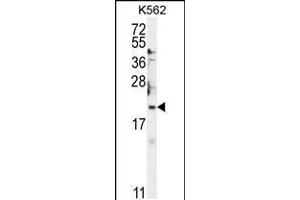 Western blot analysis in K562 cell line lysates (35ug/lane). (BTG2 antibody  (N-Term))