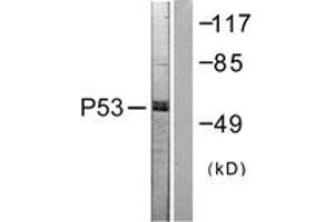 Western blot analysis of extracts from 293 cells, treated with Etoposide 25uM 60', using p53 (Ab-392) Antibody. (p53 antibody  (AA 344-393))