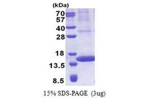 SDS-PAGE (SDS) image for Prolactin-Induced Protein (PIP) (AA 29-146) protein (His tag) (ABIN5853215) (PIP Protein (AA 29-146) (His tag))