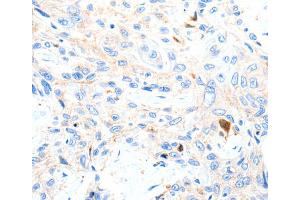 Immunohistochemistry (IHC) image for anti-Purinergic Receptor P2Y, G-Protein Coupled, 1 (P2RY1) antibody (ABIN2426307) (P2RY1 antibody)