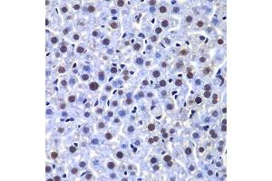 Immunohistochemistry of paraffin-embedded mouse liver using PRKDC antibody. (PRKDC antibody)