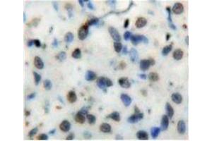 IHC-P analysis of Stomach tissue, with DAB staining. (NFkB antibody  (AA 42-367))