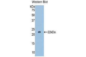 Western Blotting (WB) image for anti-Histone Deacetylase 6 (HDAC6) (AA 166-348) antibody (ABIN1176378) (HDAC6 antibody  (AA 166-348))