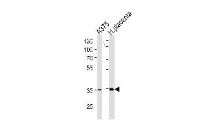 Western blot analysis in A375 cell line and human placenta tissue lysates (35ug/lane). (AKR1B1 antibody  (C-Term))