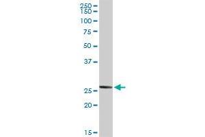 NOG MaxPab rabbit polyclonal antibody. (NOG antibody  (AA 1-232))