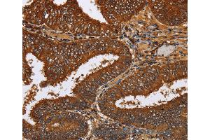 Immunohistochemistry of Human brain  using TICAM2 Polyclonal Antibody at dilution of 1:60 (TICAM2 antibody)