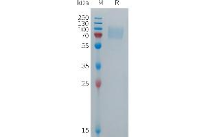 Human FB Protein, hFc Tag on SDS-PAGE under reducing condition. (FCGR3B Protein (AA 17-199) (Fc Tag))