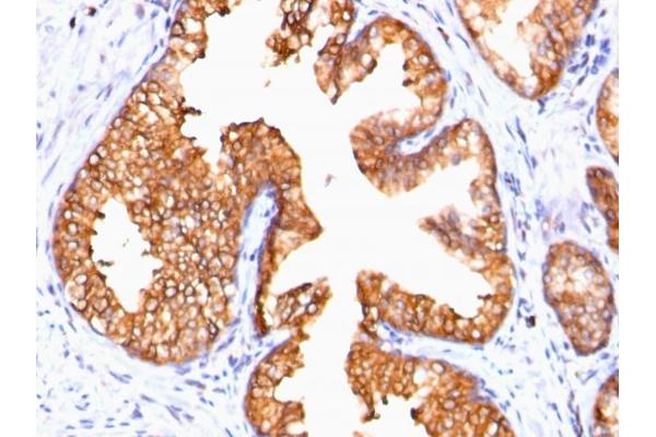 ODC1 antibody