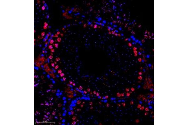 SYCP1 antibody