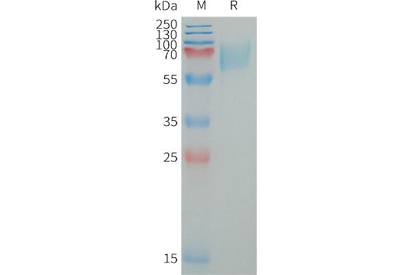 LILRA2 Protein (AA 24-449) (His tag)