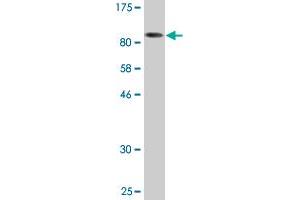 Western Blot detection against Immunogen (142. (HDAC6 antibody  (AA 1-1063))