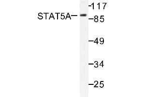 Image no. 1 for anti-Signal Transducer and Activator of Transcription 5A (STAT5A) antibody (ABIN271829) (STAT5A antibody)