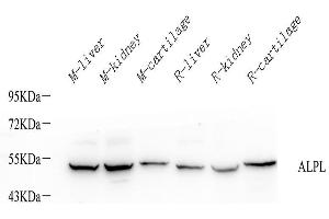 Western Blot analysis of various samples using ALPL Polyclonal Antibody at dilution of 1:1000. (ALPL antibody)