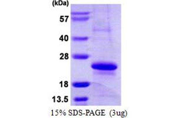 MYL12A Protein (AA 1-171) (His tag)