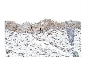 Arrestin B2 antibody was used for immunohistochemistry at a concentration of 4-8 ug/ml. (Arrestin 3 antibody  (Middle Region))