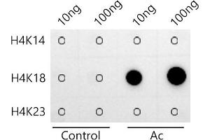 Dot-blot analysis of all sorts of peptides using Acetyl-Histone H3-K18 antibody(ABIN7267667) at 1:100000 dilution. (Histone 3 antibody  (H3K18))