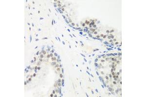 Immunohistochemistry of paraffin-embedded human prostate using PPAN antibody. (PPAN antibody)