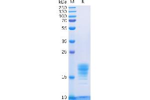 Human IL5 Protein, His Tag on SDS-PAGE under reducing condition. (IL-5 Protein (AA 20-134) (His tag))