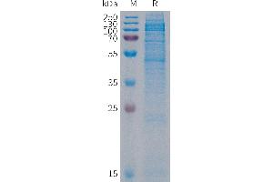 Human Protein, His Tag on SDS-PAGE under reducing condition. (CDH19 Protein (AA 44-595) (His tag))