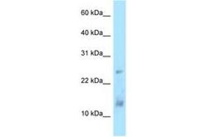 Image no. 1 for anti-Dynein, Light Chain, LC8-Type 1 (DYNLL1) (AA 33-82) antibody (ABIN6748044) (DYNLL1 antibody  (AA 33-82))