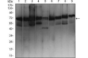 Western Blotting (WB) image for anti-Ezrin (EZR) (AA 292-464) antibody (ABIN5542456)