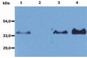 Image no. 1 for anti-Membrane-Spanning 4-Domains, Subfamily A, Member 1 (MS4A1) antibody (ABIN1100549) (CD20 antibody)