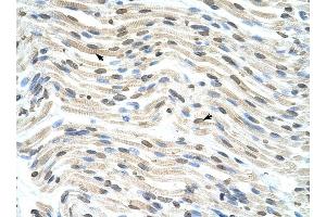 THOC3 antibody was used for immunohistochemistry at a concentration of 4-8 ug/ml to stain Myocardial cells (arrows) in Human Heart. (THO Complex 3 antibody  (Middle Region))