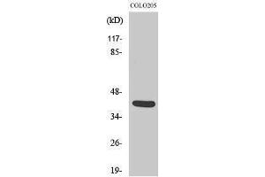 Western Blotting (WB) image for anti-Vasohibin 1 (VASH1) (Internal Region) antibody (ABIN6282445) (VASH1 antibody  (Internal Region))