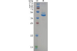 Human NEFL Protein, hFc Tag on SDS-PAGE under reducing condition. (NEFL Protein (AA 2-543) (Fc Tag))