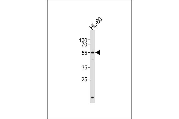 DGCR14 antibody  (C-Term)