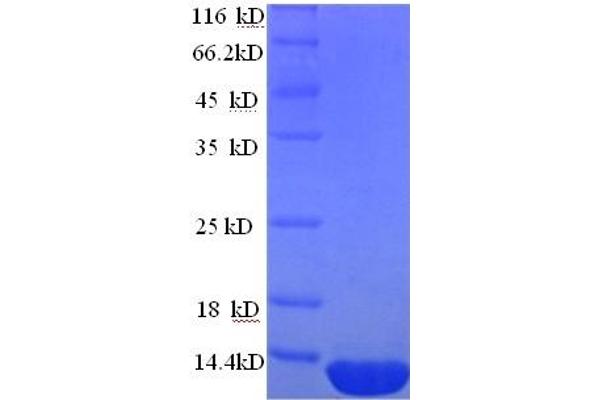 DEFB124 Protein (AA 23-71) (His tag)