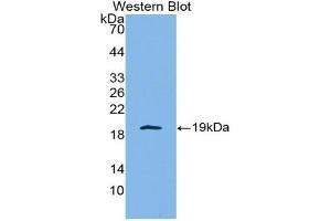 Western blot analysis of the recombinant protein. (IL-4 antibody  (AA 25-153))