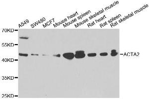 Western blot analysis of extracts of various cell lines, using ACTA2 antibody. (Smooth Muscle Actin antibody  (AA 1-124))