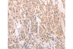 Immunohistochemistry (IHC) image for anti-Apoptotic Chromatin Condensation Inducer 1 (ACIN1) antibody (ABIN2432419) (ACIN1 antibody)